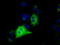 Insulin Like Growth Factor 2 MRNA Binding Protein 2 antibody, LS-C115284, Lifespan Biosciences, Immunofluorescence image 