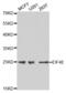 Eukaryotic Translation Initiation Factor 4E antibody, abx001774, Abbexa, Western Blot image 