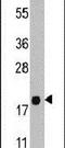 Pro-Platelet Basic Protein antibody, PA5-14492, Invitrogen Antibodies, Western Blot image 