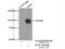 Wolframin ER Transmembrane Glycoprotein antibody, 11558-1-AP, Proteintech Group, Immunoprecipitation image 