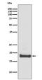 ADP Ribosylation Factor 6 antibody, M00927, Boster Biological Technology, Western Blot image 