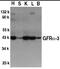 GDNF Family Receptor Alpha 3 antibody, MBS395759, MyBioSource, Western Blot image 