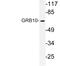 Growth Factor Receptor Bound Protein 10 antibody, LS-C176598, Lifespan Biosciences, Western Blot image 