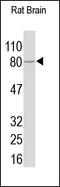 Alkaline Phosphatase, Biomineralization Associated antibody, 251825, Abbiotec, Western Blot image 