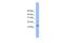 ATP Synthase Peripheral Stalk Subunit D antibody, PA5-43776, Invitrogen Antibodies, Western Blot image 