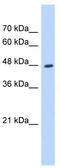 Hydroxyacyl-CoA Dehydrogenase Trifunctional Multienzyme Complex Subunit Beta antibody, TA346528, Origene, Western Blot image 