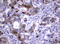 TNKS antibody, LS-C175666, Lifespan Biosciences, Immunohistochemistry paraffin image 