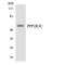 Protein Phosphatase 2 Regulatory Subunit B''Gamma antibody, LS-C200517, Lifespan Biosciences, Western Blot image 