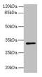 Phospholipid Phosphatase 2 antibody, CSB-PA018416LA01HU, Cusabio, Western Blot image 