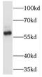 TNF Receptor Associated Factor 6 antibody, FNab08921, FineTest, Western Blot image 