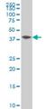 NFKB Inhibitor Beta antibody, H00004793-M02, Novus Biologicals, Western Blot image 