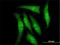 Dual Specificity Tyrosine Phosphorylation Regulated Kinase 2 antibody, H00008445-M02, Novus Biologicals, Immunofluorescence image 