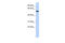 Zinc Finger Protein 248 antibody, 25-308, ProSci, Western Blot image 