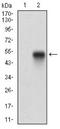 Platelet Derived Growth Factor Receptor Alpha antibody, NBP2-52528, Novus Biologicals, Western Blot image 