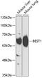 Bestrophin 1 antibody, GTX65886, GeneTex, Western Blot image 