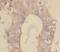 Vacuolar Protein Sorting 25 Homolog antibody, FNab09431, FineTest, Immunohistochemistry paraffin image 