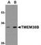 Transmembrane Protein 38B antibody, TA306889, Origene, Western Blot image 