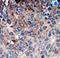 NME/NM23 Nucleoside Diphosphate Kinase 1 antibody, LS-C101172, Lifespan Biosciences, Immunohistochemistry paraffin image 