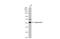 Keratin 7 antibody, GTX109723, GeneTex, Western Blot image 