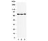 TGF-Beta Activated Kinase 1 (MAP3K7) Binding Protein 2 antibody, R31413, NSJ Bioreagents, Western Blot image 