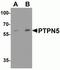 Protein Tyrosine Phosphatase Non-Receptor Type 5 antibody, NBP2-81893, Novus Biologicals, Western Blot image 