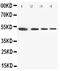 Annexin A7 antibody, PA2076, Boster Biological Technology, Western Blot image 