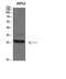 Tryptase Delta 1 antibody, A13747, Boster Biological Technology, Western Blot image 