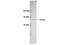 Matrix Metallopeptidase 14 antibody, NBP2-29735, Novus Biologicals, Western Blot image 