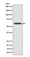 Keratin 5 antibody, M00398-2, Boster Biological Technology, Western Blot image 