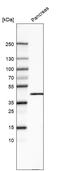 Carboxypeptidase A1 antibody, AMAb91434, Atlas Antibodies, Western Blot image 