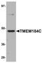 Transmembrane Protein 184C antibody, PA5-20933, Invitrogen Antibodies, Western Blot image 