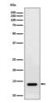 Ring Finger Protein 7 antibody, M05620-1, Boster Biological Technology, Western Blot image 