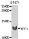 Trefoil Factor 1 antibody, A1789, ABclonal Technology, Western Blot image 