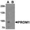 Prominin 1 antibody, A01767-1, Boster Biological Technology, Western Blot image 