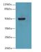 Keratin 80 antibody, A65642-100, Epigentek, Western Blot image 