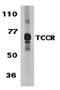 Interleukin 27 Receptor Subunit Alpha antibody, orb74454, Biorbyt, Western Blot image 