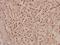 Mediator Complex Subunit 17 antibody, A05399, Boster Biological Technology, Immunohistochemistry paraffin image 
