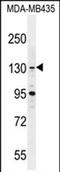 BRD4 Interacting Chromatin Remodeling Complex Associated Protein antibody, PA5-71493, Invitrogen Antibodies, Western Blot image 