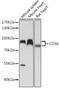 CD36 Molecule antibody, GTX55559, GeneTex, Western Blot image 