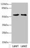 Solute Carrier Family 30 Member 1 antibody, LS-C676509, Lifespan Biosciences, Western Blot image 