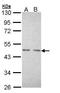 Nuclear Receptor Subfamily 2 Group C Member 1 antibody, GTX108704, GeneTex, Western Blot image 