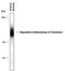 Dopamine Beta-Hydroxylase antibody, PPS066, R&D Systems, Western Blot image 