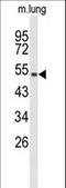 MutY DNA Glycosylase antibody, LS-C164686, Lifespan Biosciences, Western Blot image 