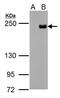 Methylcytosine dioxygenase TET3 antibody, GTX121452, GeneTex, Western Blot image 