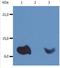 Beta-2-Microglobulin antibody, NB110-60015, Novus Biologicals, Western Blot image 