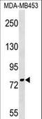 Polyribonucleotide Nucleotidyltransferase 1 antibody, LS-C158691, Lifespan Biosciences, Western Blot image 