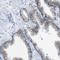 CD46 Molecule antibody, NBP1-82790, Novus Biologicals, Immunohistochemistry paraffin image 