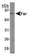 FER Tyrosine Kinase antibody, TA336745, Origene, Western Blot image 