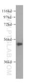 CWC27 Spliceosome Associated Cyclophilin antibody, 16502-1-AP, Proteintech Group, Western Blot image 