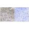 Solute Carrier Family 25 Member 21 antibody, A11791, Boster Biological Technology, Immunohistochemistry frozen image 